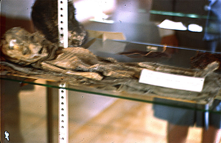 'Alien Autopsy' Slides Revealed - Or Is It Just a Mummy?