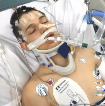 Texas Teen Says He Saw Jesus Before Being Revived