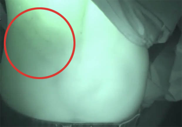 'Ghost' Attacks Cameraman and Leaves Mysterious Scratches