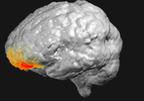 Man's Brain Activity Recorded at the Exact Moment He 'Saw God'