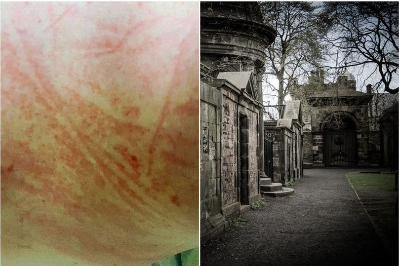 Tourist Claims to Be Attacked by Vicious Edinburgh Poltergeist