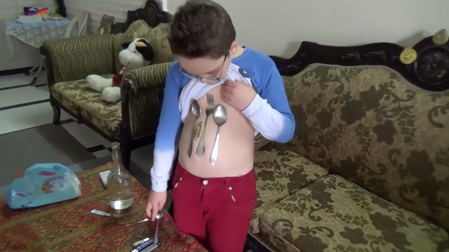 Syrian Boy Boasts 'Magnetic Belly'