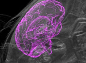 Scientists Grow 'Human Mini-Brains' Inside Rat Bodies