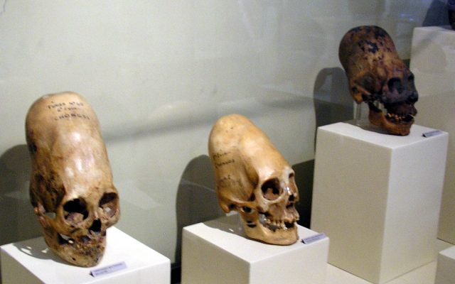 Elongated Peruvian Skulls May Have Been Elite Humans