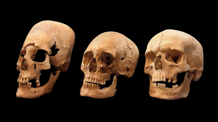 Bavarian Cone-headed Women Had 'Vastly Different Genetics'