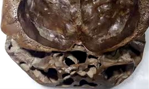 Alien Skull Found in China?