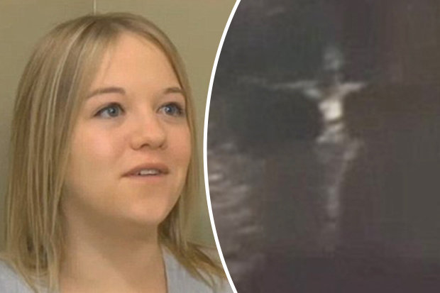 'Jesus on the Cross' Appears in Ultrasound Image